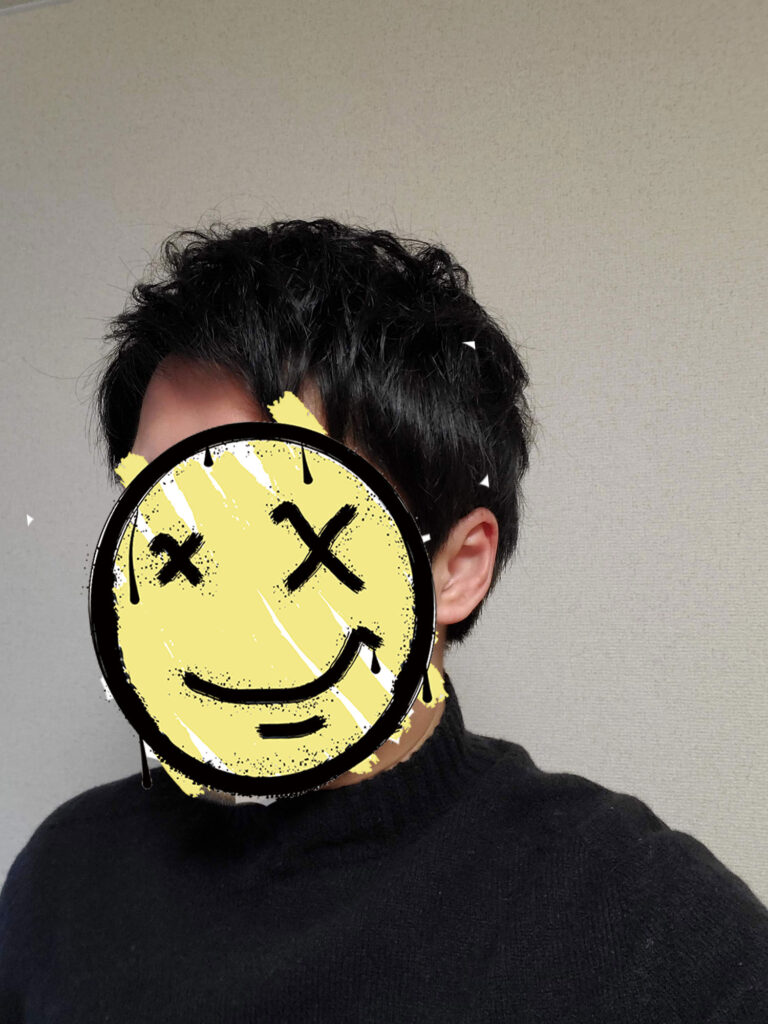 編み込み式カツラのテカり方
