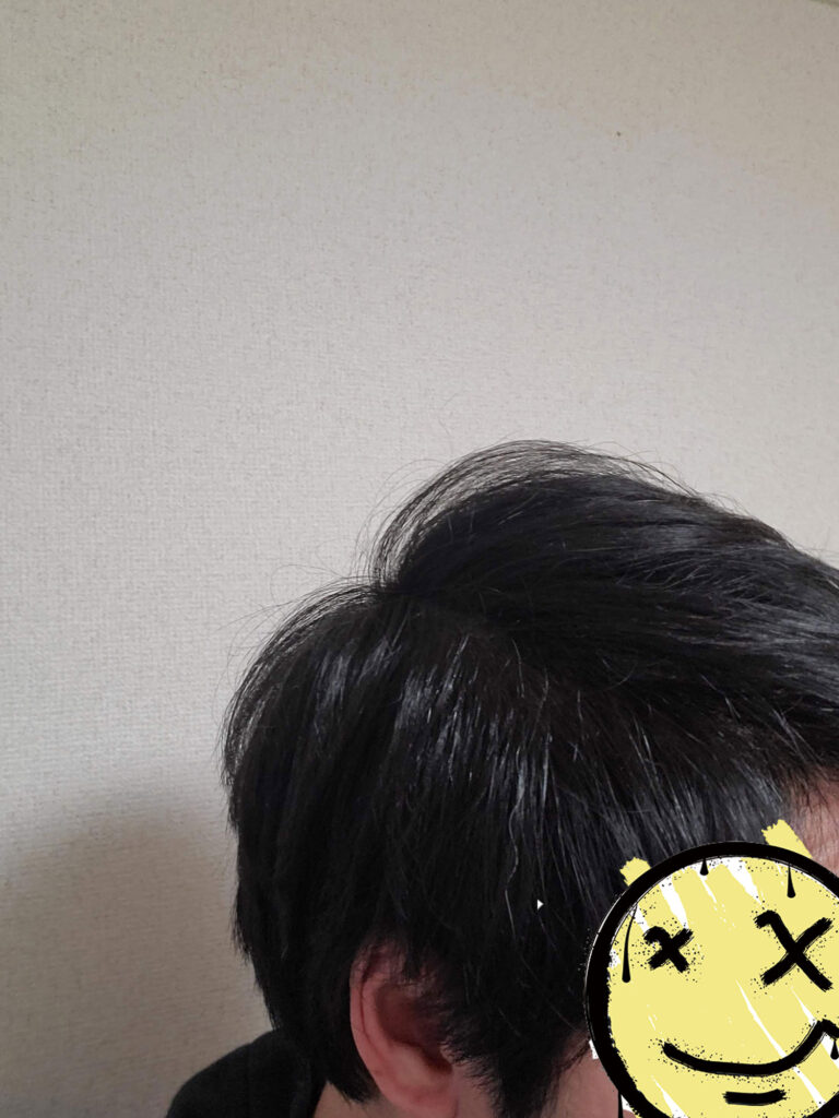 スーパーミリオンヘアー使用後