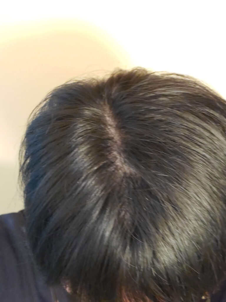 スーパーミリオンヘアー使用後