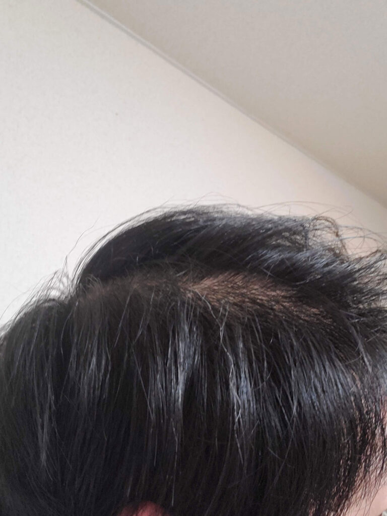 スーパーミリオンヘアー使用前